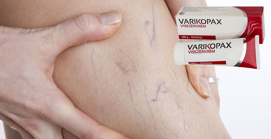 varikopax_web Varikopax visszérkrém
